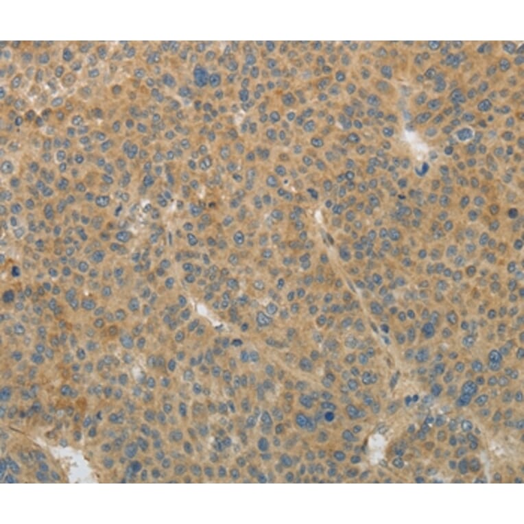 Immunohistochemistry - TGFB1 Antibody from Signalway Antibody (35958) - Antibodies.com