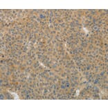 Immunohistochemistry - TGFB1 Antibody from Signalway Antibody (35958) - Antibodies.com