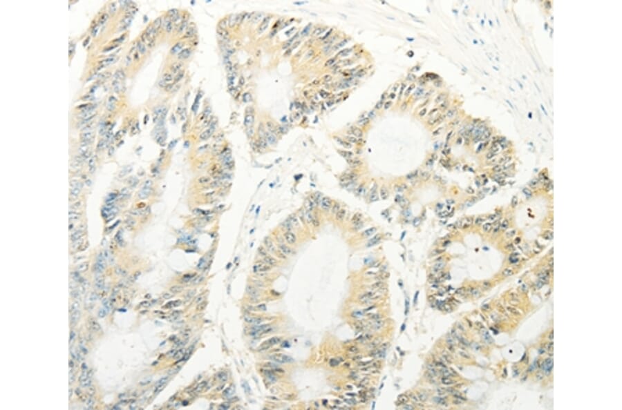 Immunohistochemistry - TRAF1 Antibody from Signalway Antibody (35967) - Antibodies.com
