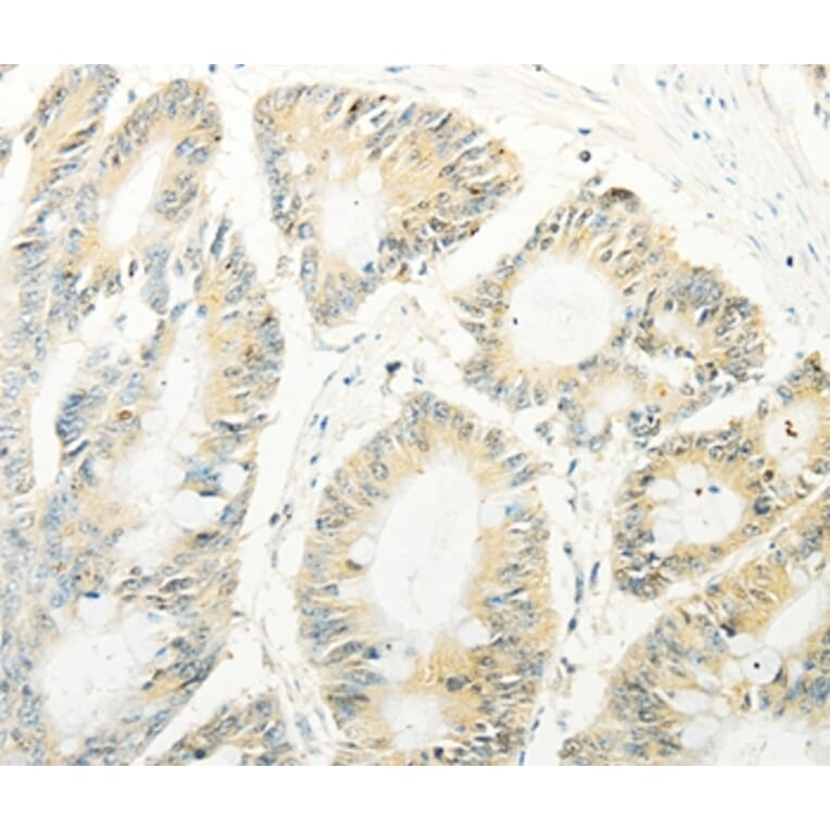 Immunohistochemistry - TRAF1 Antibody from Signalway Antibody (35967) - Antibodies.com