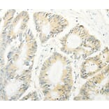 Immunohistochemistry - TRAF1 Antibody from Signalway Antibody (35967) - Antibodies.com