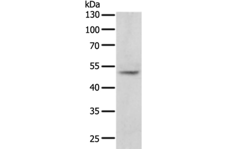 TERF1 Antibody from Signalway Antibody (35974) - Antibodies.com