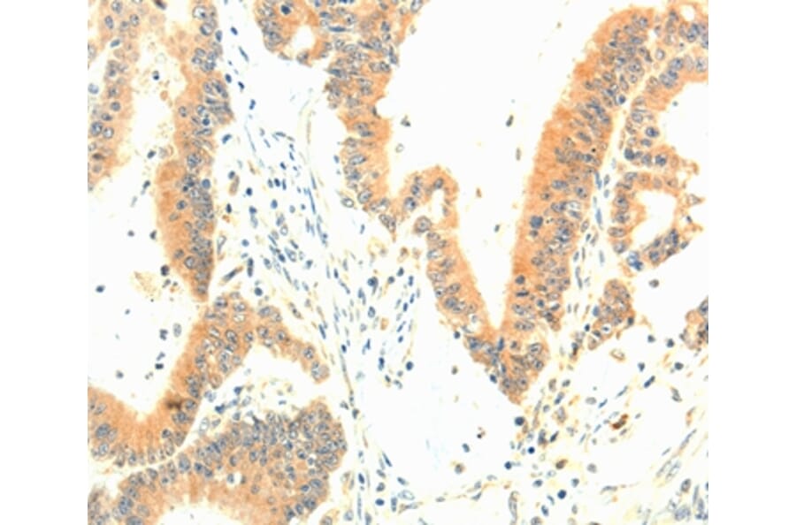 Immunohistochemistry - TERF1 Antibody from Signalway Antibody (35974) - Antibodies.com