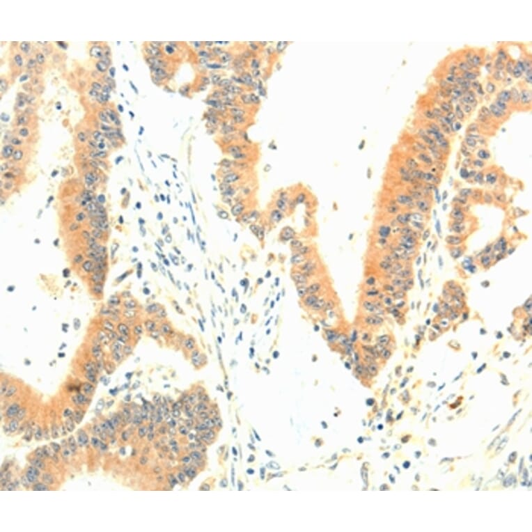 Immunohistochemistry - TERF1 Antibody from Signalway Antibody (35974) - Antibodies.com