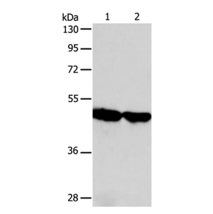 AADAC Antibody from Signalway Antibody (36000) - Antibodies.com