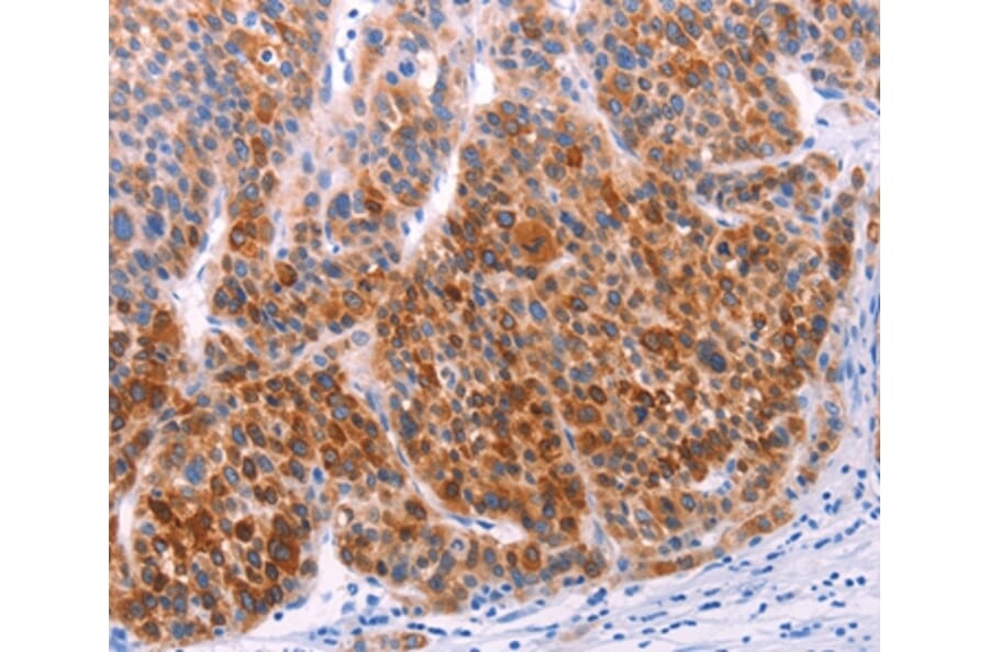 Immunohistochemistry - AADAC Antibody from Signalway Antibody (36000) - Antibodies.com
