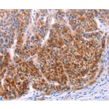 Immunohistochemistry - AADAC Antibody from Signalway Antibody (36000) - Antibodies.com