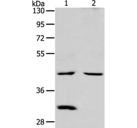NCEH1 Antibody from Signalway Antibody (36001) - Antibodies.com