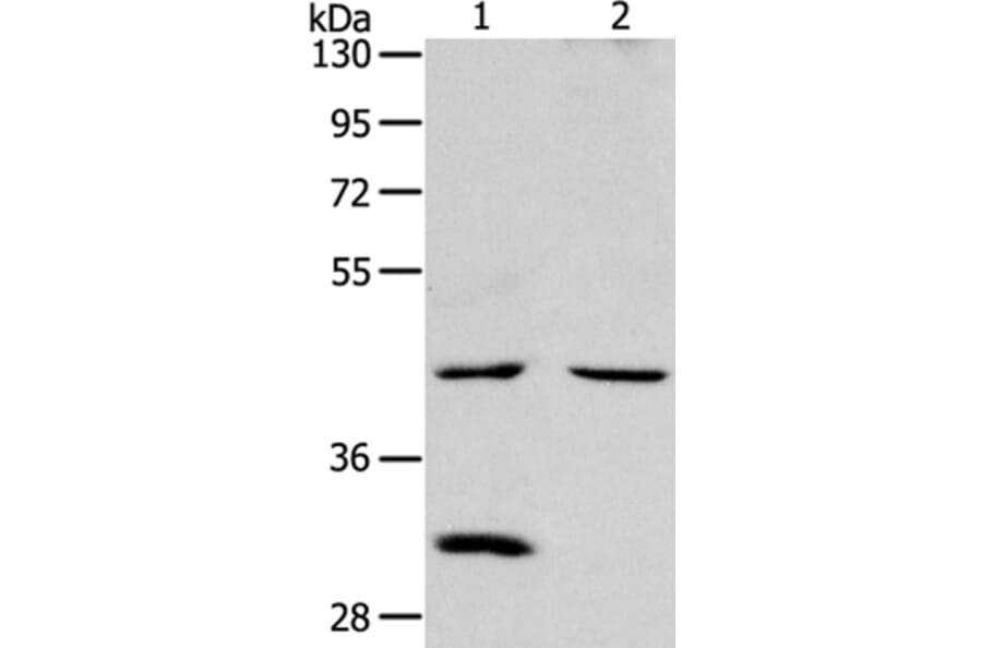 NCEH1 Antibody from Signalway Antibody (36001) - Antibodies.com