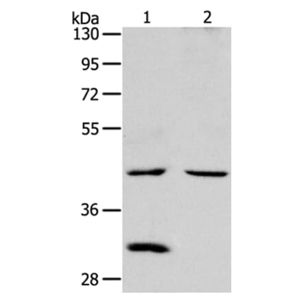 NCEH1 Antibody from Signalway Antibody (36001) - Antibodies.com