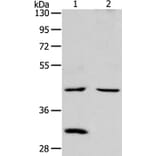 NCEH1 Antibody from Signalway Antibody (36001) - Antibodies.com