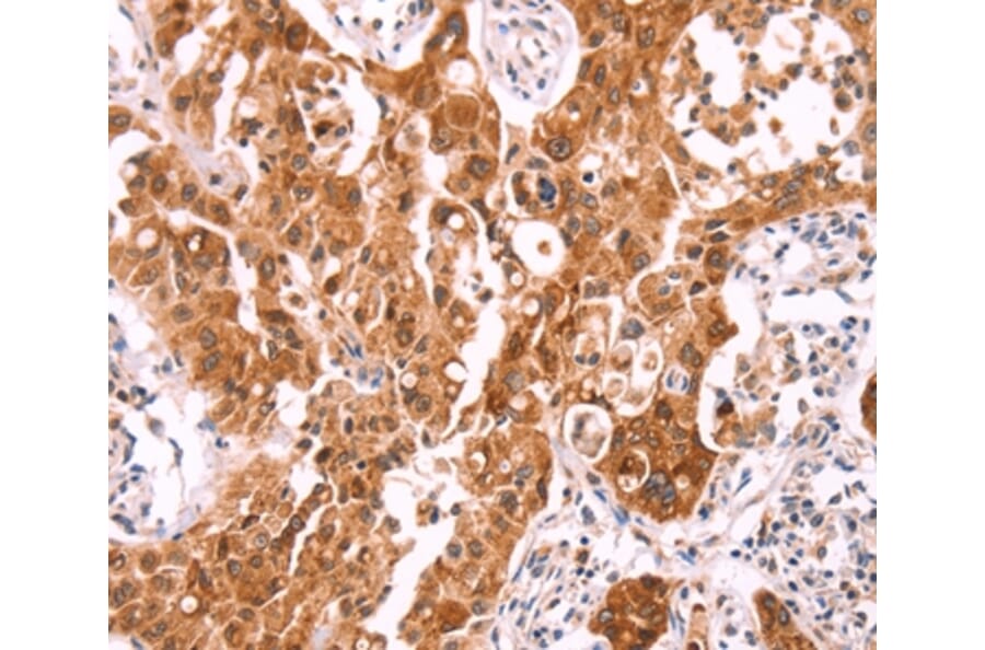 Immunohistochemistry - NCEH1 Antibody from Signalway Antibody (36001) - Antibodies.com