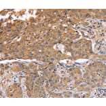 Immunohistochemistry - ABCB6 Antibody from Signalway Antibody (36003) - Antibodies.com