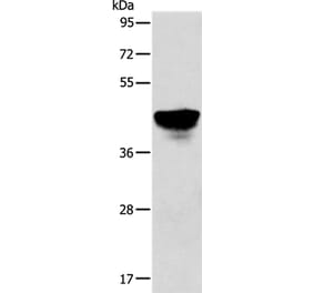 ABHD5 Antibody from Signalway Antibody (36010) - Antibodies.com
