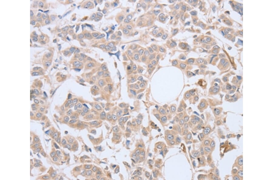 Immunohistochemistry - ABHD5 Antibody from Signalway Antibody (36010) - Antibodies.com