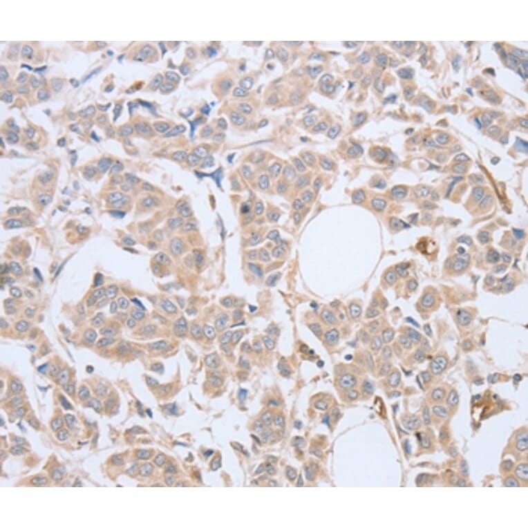 Immunohistochemistry - ABHD5 Antibody from Signalway Antibody (36010) - Antibodies.com