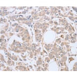 Immunohistochemistry - ABHD5 Antibody from Signalway Antibody (36010) - Antibodies.com