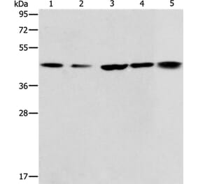 ACAA2 Antibody from Signalway Antibody (36013) - Antibodies.com
