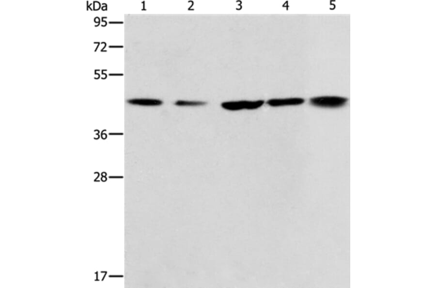ACAA2 Antibody from Signalway Antibody (36013) - Antibodies.com