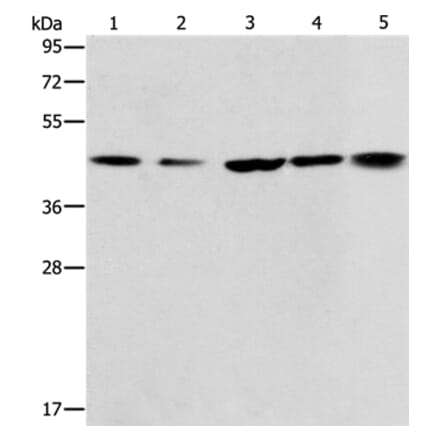 ACAA2 Antibody from Signalway Antibody (36013) - Antibodies.com