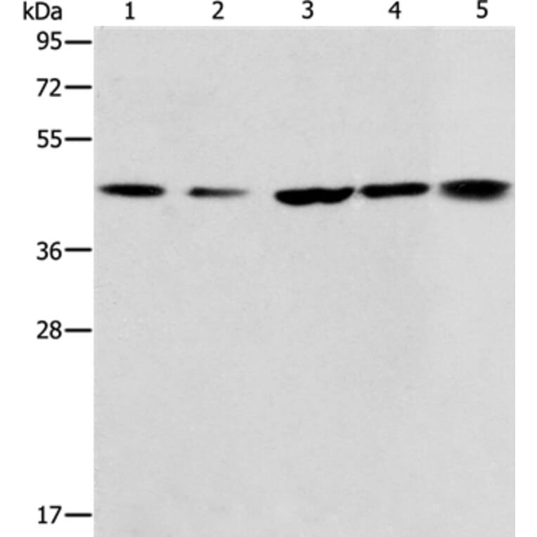 ACAA2 Antibody from Signalway Antibody (36013) - Antibodies.com