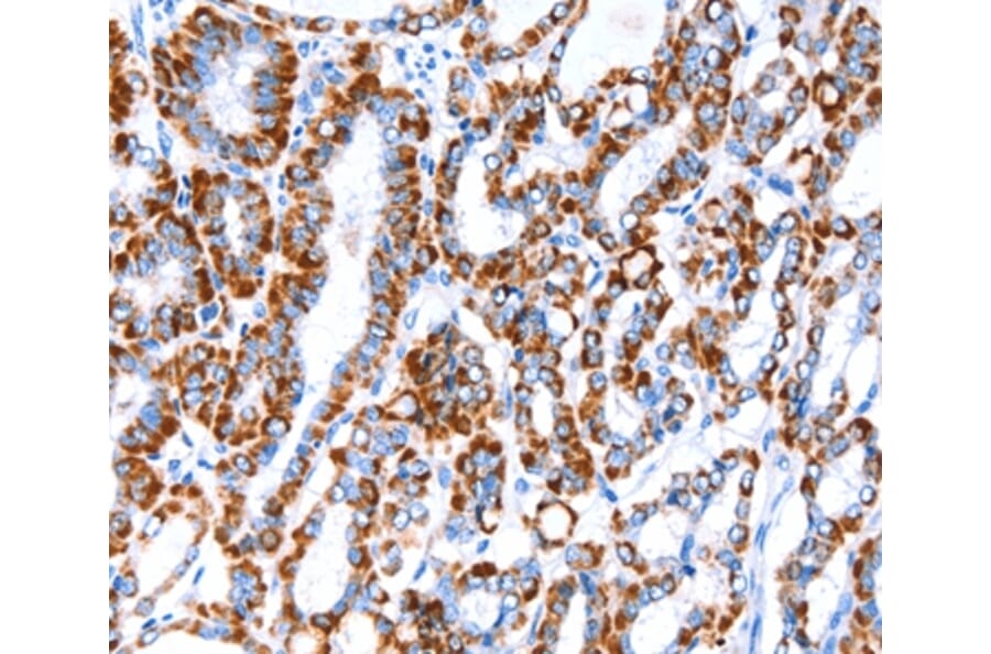 Immunohistochemistry - ACAA2 Antibody from Signalway Antibody (36013) - Antibodies.com