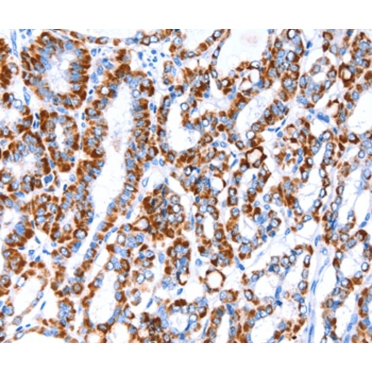 Immunohistochemistry - ACAA2 Antibody from Signalway Antibody (36013) - Antibodies.com