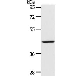 ACADS Antibody from Signalway Antibody (36017) - Antibodies.com
