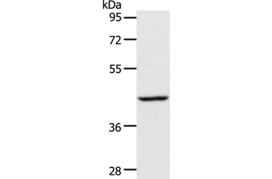 ACADS Antibody from Signalway Antibody (36017) - Antibodies.com