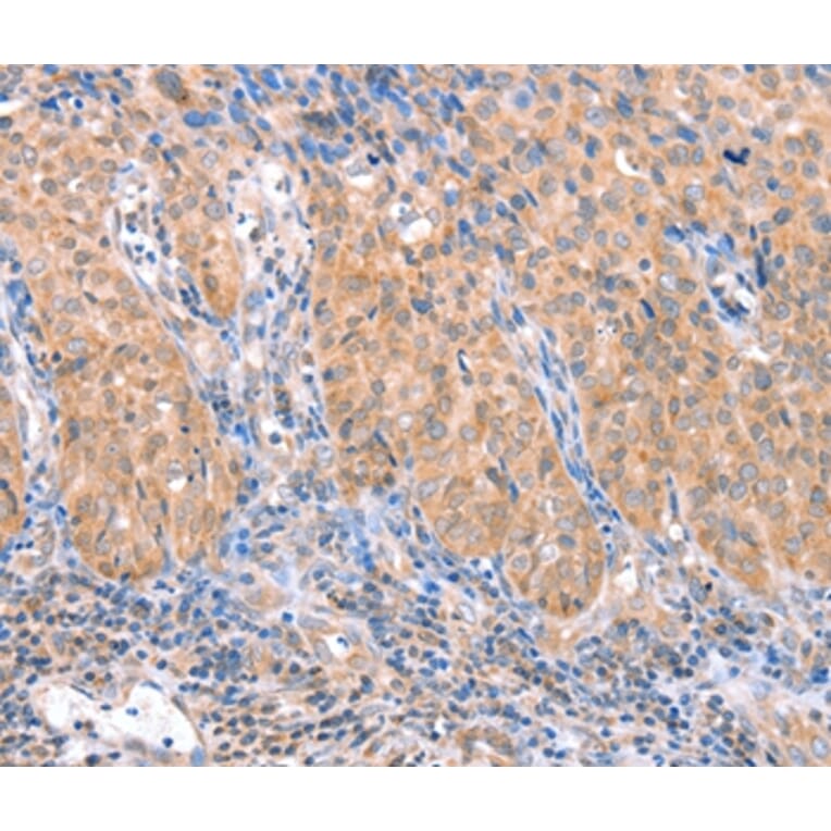 Immunohistochemistry - ACADS Antibody from Signalway Antibody (36017) - Antibodies.com