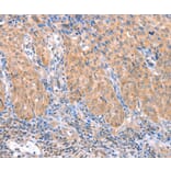 Immunohistochemistry - ACADS Antibody from Signalway Antibody (36017) - Antibodies.com