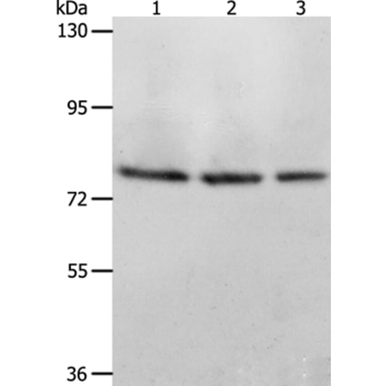 ACOX1 Antibody from Signalway Antibody (36021) - Antibodies.com