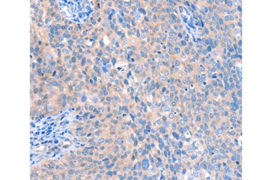 Immunohistochemistry - ACOX1 Antibody from Signalway Antibody (36021) - Antibodies.com