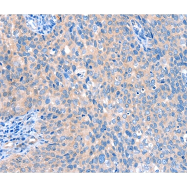 Immunohistochemistry - ACOX1 Antibody from Signalway Antibody (36021) - Antibodies.com