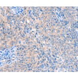 Immunohistochemistry - ACOX1 Antibody from Signalway Antibody (36021) - Antibodies.com