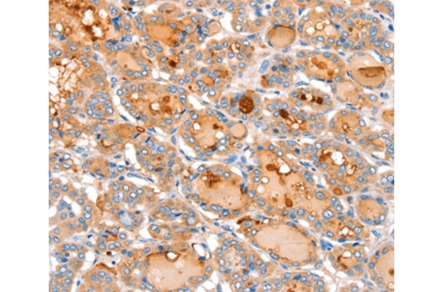Immunohistochemistry - ACOX2 Antibody from Signalway Antibody (36023) - Antibodies.com