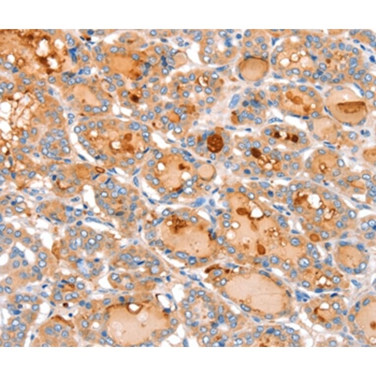 Immunohistochemistry - ACOX2 Antibody from Signalway Antibody (36023) - Antibodies.com