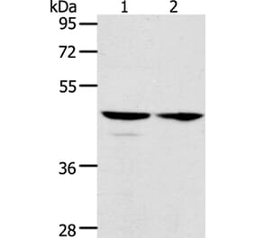 ACTL8 Antibody from Signalway Antibody (36030) - Antibodies.com