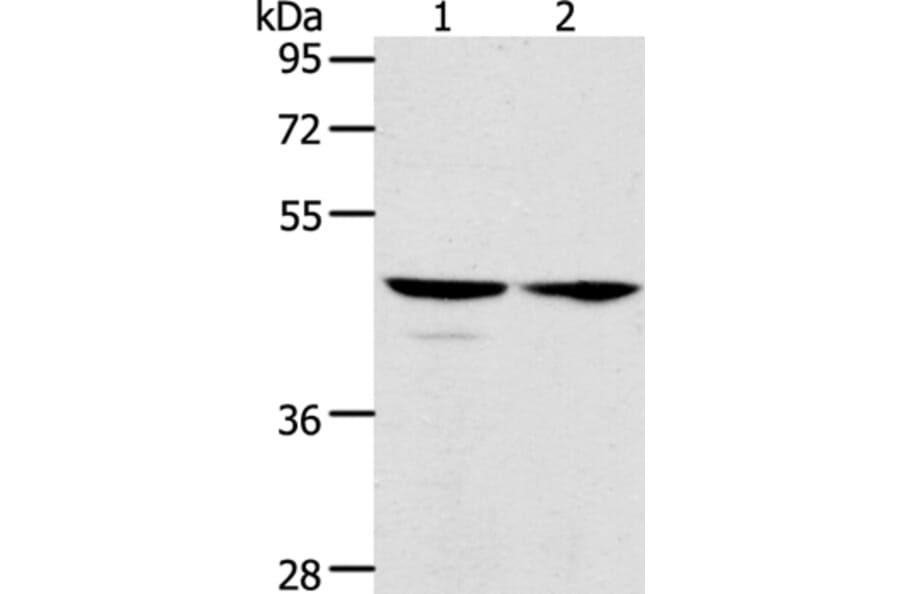 ACTL8 Antibody from Signalway Antibody (36030) - Antibodies.com