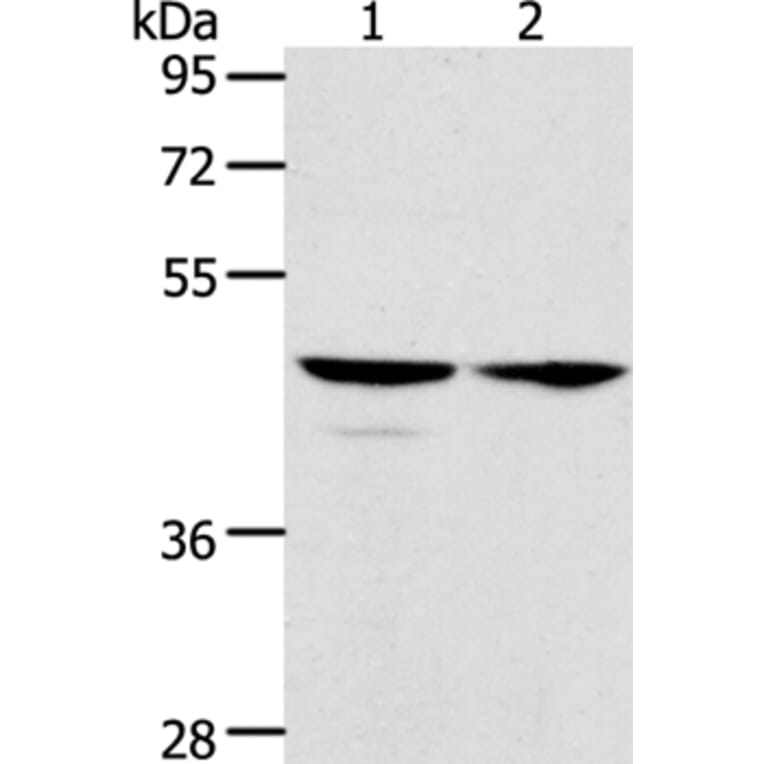 ACTL8 Antibody from Signalway Antibody (36030) - Antibodies.com