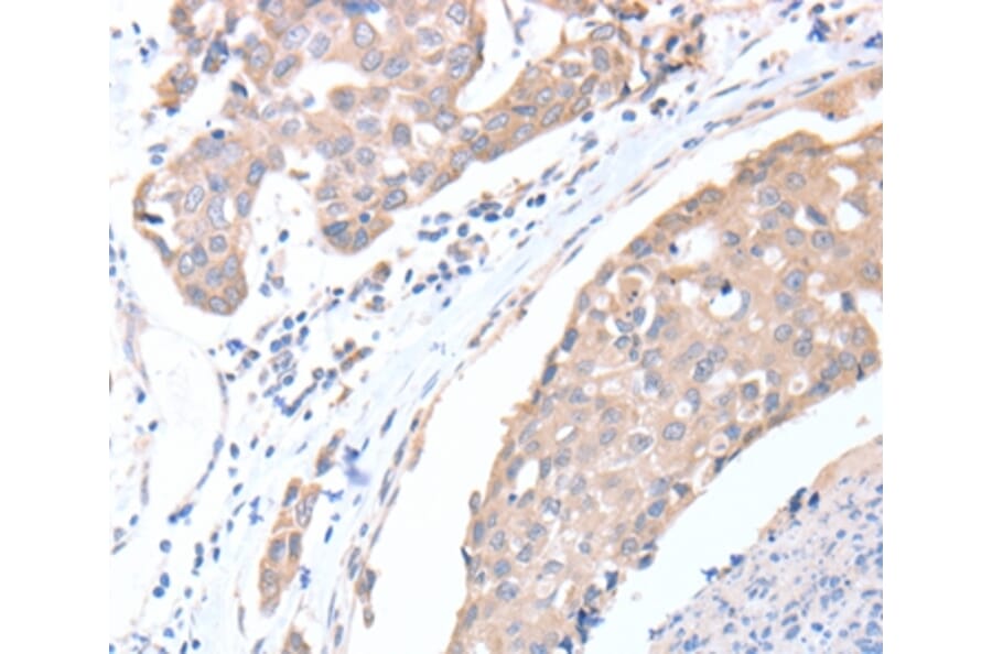 Immunohistochemistry - ACTL8 Antibody from Signalway Antibody (36030) - Antibodies.com