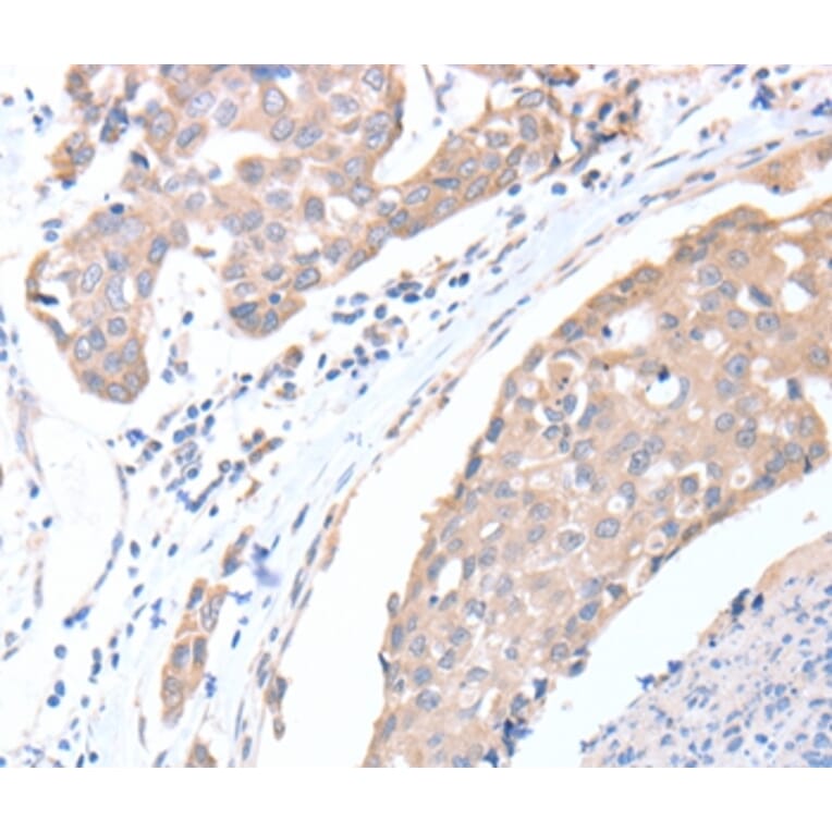 Immunohistochemistry - ACTL8 Antibody from Signalway Antibody (36030) - Antibodies.com