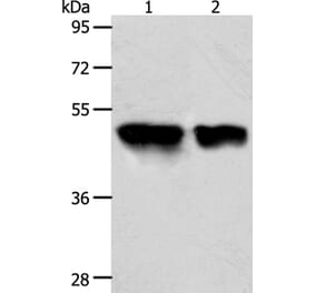 ACOT9 Antibody from Signalway Antibody (36035) - Antibodies.com