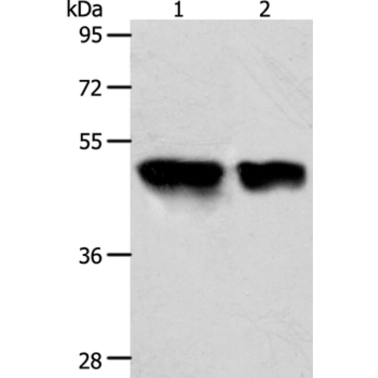 ACOT9 Antibody from Signalway Antibody (36035) - Antibodies.com