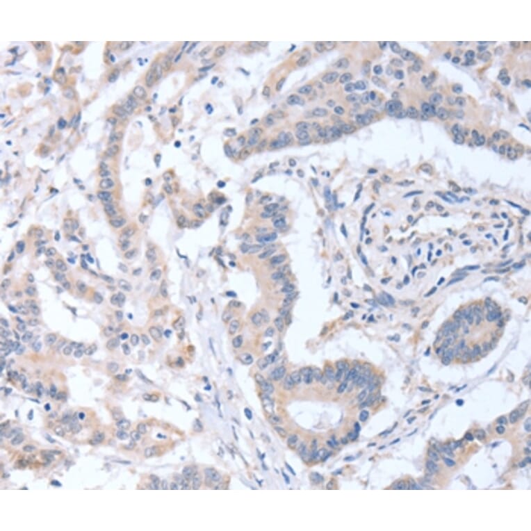 Immunohistochemistry - ACOT9 Antibody from Signalway Antibody (36035) - Antibodies.com
