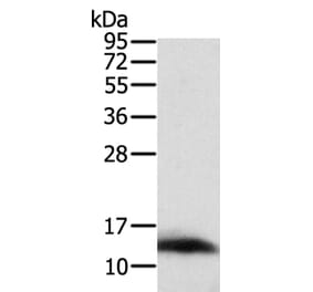 ACYP1 Antibody from Signalway Antibody (36037) - Antibodies.com
