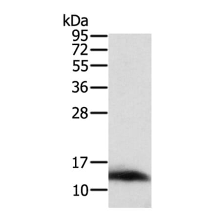 ACYP1 Antibody from Signalway Antibody (36037) - Antibodies.com