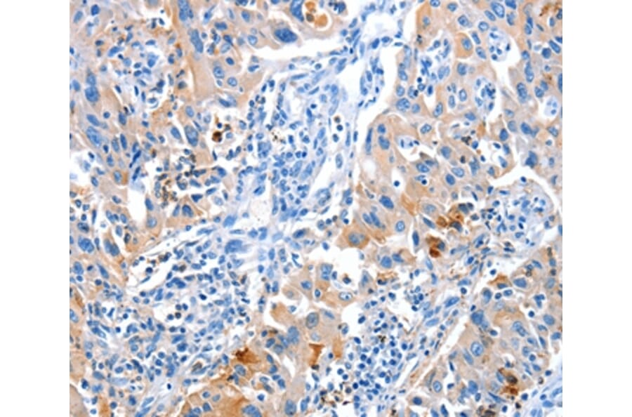 Immunohistochemistry - ACYP1 Antibody from Signalway Antibody (36037) - Antibodies.com
