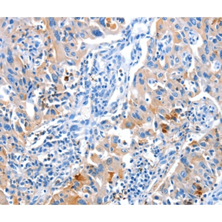 Immunohistochemistry - ACYP1 Antibody from Signalway Antibody (36037) - Antibodies.com