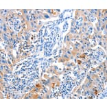 Immunohistochemistry - ACYP1 Antibody from Signalway Antibody (36037) - Antibodies.com